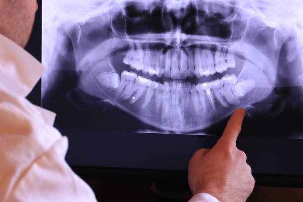 Best Emergency Tooth Extraction in Mccormick, SC